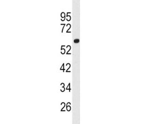 Western blot analysis of ACSL3 antibody and human 293 lysate. Predicted molecular weight ~80 kDa.