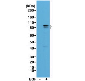 STAT3 Antibody (pTyr705)