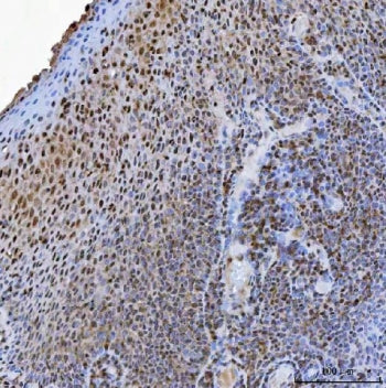 IHC staining of FFPE human tonsil tissue with USP26 antibody. HIER: boil tissue sections in pH8 EDTA
