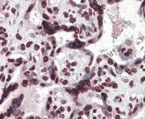 HMGA1 Antibody