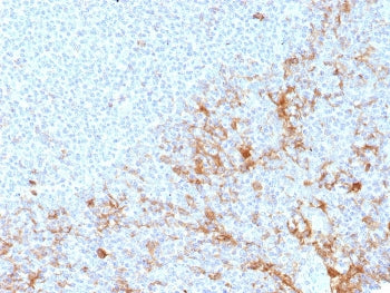 FCGR1A Antibody / CD64