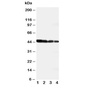 Western blot testing of DLL3 antibody and recombinant human protein; Lane 1: 10ng; 2: 5ng; 3: 2.5ng;