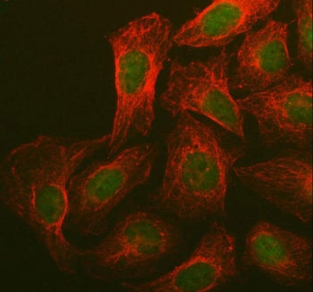 Immunofluorescent staining of FFPE human U-2 OS cells with BRCA1 antibody (green) and Beta Tubulin m