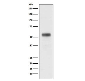 RARA Antibody / Retinoic Acid Receptor Alpha