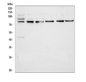 Western blot testing of 1) human A549, 2) human Jurkat, 3) human HEL, 4) rat testis, 5) mouse testis