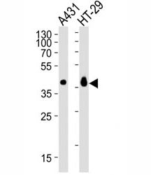 Western blot analysis of lysate from A431, HT-29 cell line (left to right) using Ep-CAM antibody dil