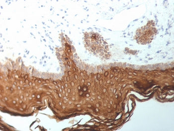 IHC staining of FFPE human skin with Cytokeratin 5/6/18 antibody (clone SPM267). HIER: boil tissue s
