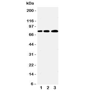 Western blot testing of PLK2 antibody and Lane 1: A431; 2: 293T; 3: COLO320 cell lysate. Predicted m