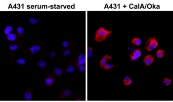 ICC of serum-starved human A431 cells non-treated or treated with Calyculin A/Okadaic Acid, using th