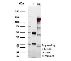 SDS-PAGE analysis of purified, BSA-free recombinant Complement 4d antibody (clone C4D/9213R) as conf