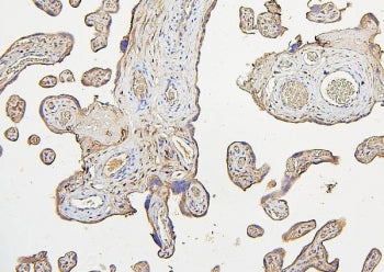 IRS1 Antibody