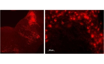 Tryptophan hydroxylase 2 Antibody / Tph2