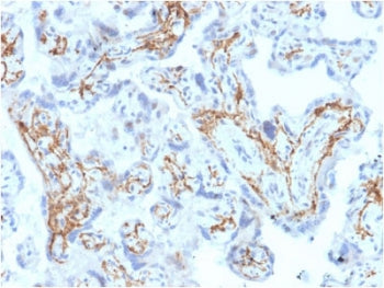 GSTM1 Antibody / Glutathione S-Transferase mu 1