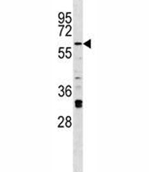 Irak2 Antibody