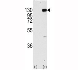 Fibroblast growth factor receptor 1 Antibody (FGFR1)