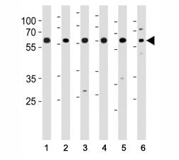 HDAC1 Antibody