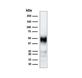 Western blot testing of human Jurkat cell lysate using recombinant CD2 antibody (clone LFA2/3417R). 
