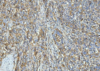 ICAM1 Antibody / CD54