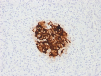 Insulin Antibody