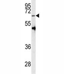 PRMT5 Antibody