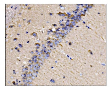 IHC staining of FFPE mouse brain tissue with Dynamin 3 antibody. HIER: boil tissue sections in pH8 E