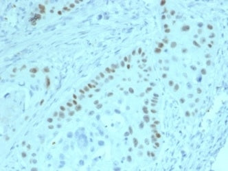 p63 Antibody / Tumor protein 63
