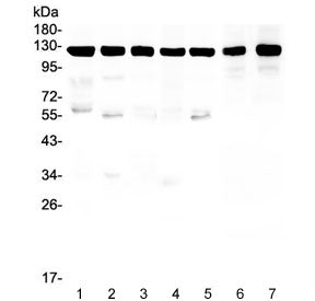 Amyloid beta Antibody / APP