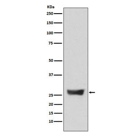 NDUFS3 Antibody