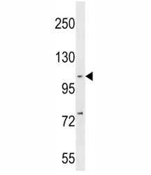 NFKB1 Antibody