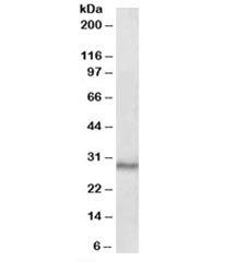 CTDSP1 Antibody