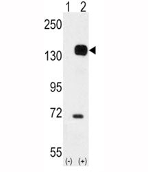 TIE2 Antibody