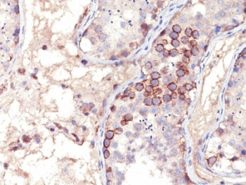 MAGE-1 Antibody