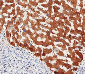 Haptoglobin Antibody