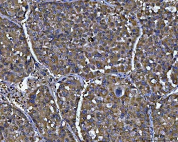 NIT2 Antibody / Nitrilase homolog 2