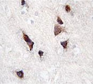 IHC testing of FFPE human brain tissue with KCNIP3 antibody. HIER: steam section in pH6 citrate buff
