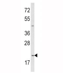 Western blot analysis of IL-12 antibody and MDA-MB231 lysate. Predicted molecular weight ~25 kDa (un