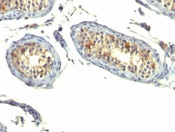 TGF alpha Antibody