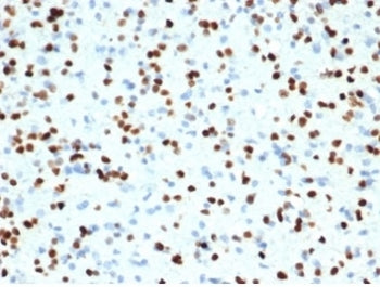 IHC staining of FFPE human brain tissue with recombinant OLIG2 antibody (clone OLIG2/7074R). HIER: b