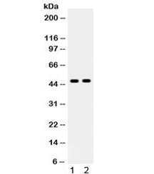 Western blot testing of 1) human HeLa and 2) mouse HEPA1-6 cell lysate with AT1R antibody. Observed 