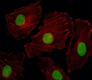 Fluorescent image of HUVEC cells stained with ISL2 antibody. Alexa Fluor 488 secondary was used. Cyt