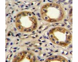 CXCR3 antibody immunohistochemistry analysis in formalin fixed and paraffin embedded human kidney ti