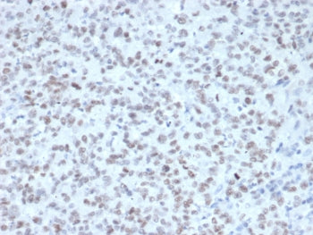 IHC staining of FFPE human tonsil tissue with Enhancer of zeste homolog 2 antibody (clone EZH2/4687)