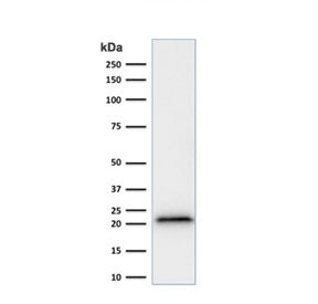 p21 Antibody / CDKN1A