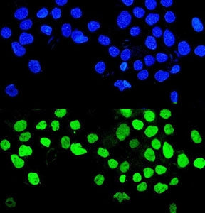 Immunofluorescent staining of FFPE human A431 cells with MMP28 antibody (green) and DAPI nuclear sta