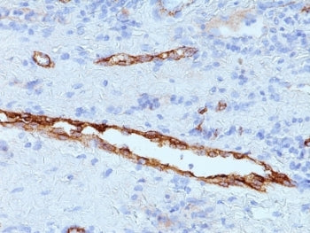 von Willebrand Factor Antibody / vWF