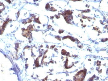ZFYVE28 Antibody