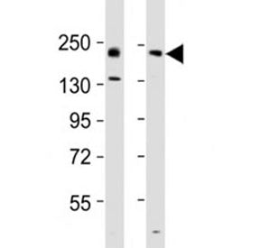 Western blot testing of Erbb2 antibody at 1:2000 dilution. Lane 1: mouse ovary lysate; 2: rat lung l