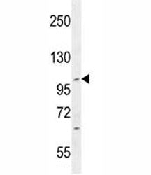 IFT88 Antibody