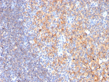 CD19 Antibody / B-lymphocyte marker