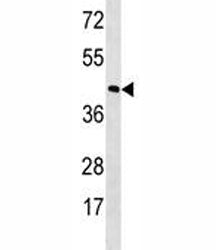 Rhodopsin Antibody (RHO)